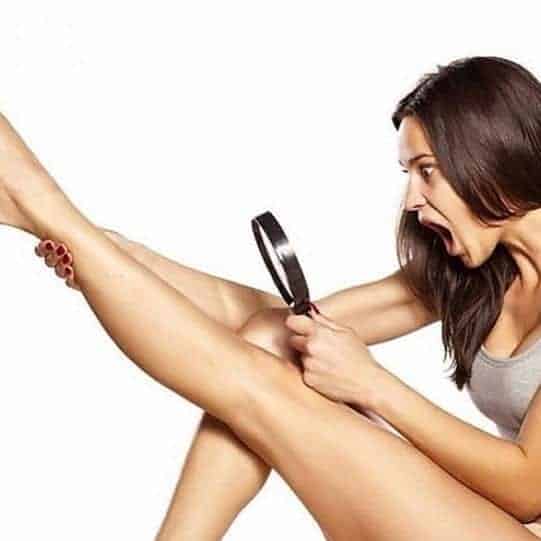 laserontharing vrouwen benen laserline